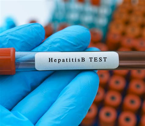 b e q u e a t h e d|Understanding Your Hepatitis B Blood Tests.